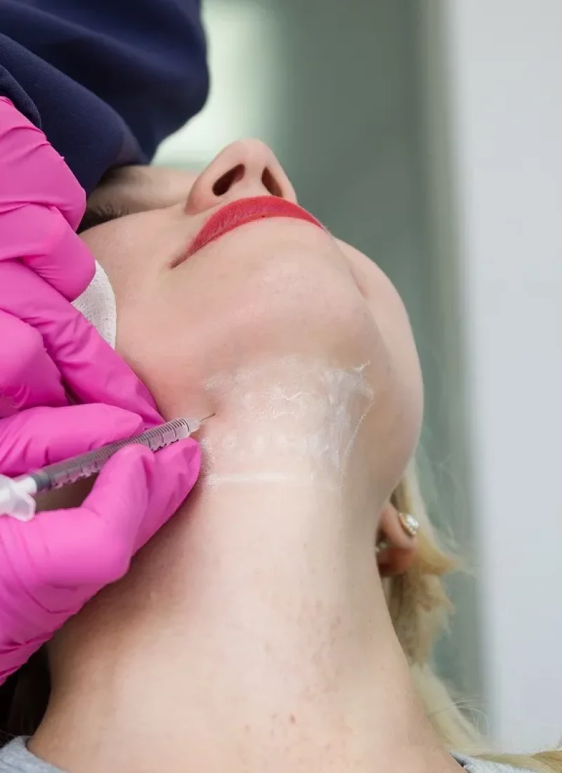 Kybella in Fayetteville, TN